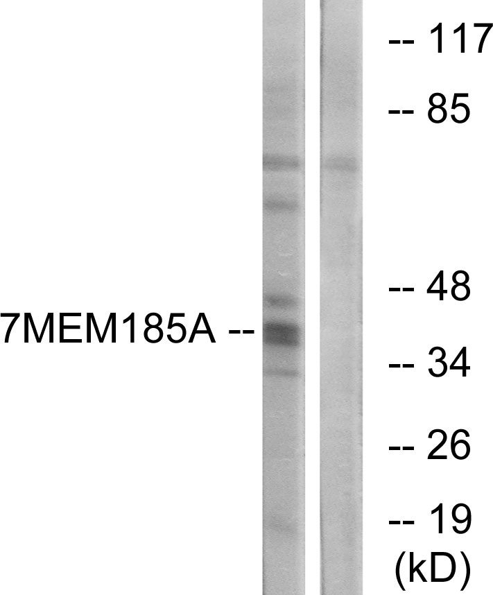 TMEM185A Ab