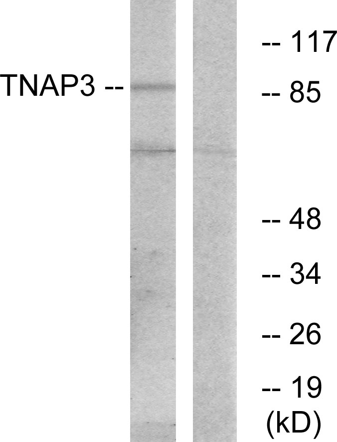 TNFAIP3 Ab