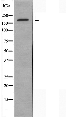 Topoisomerase 2 alpha Ab