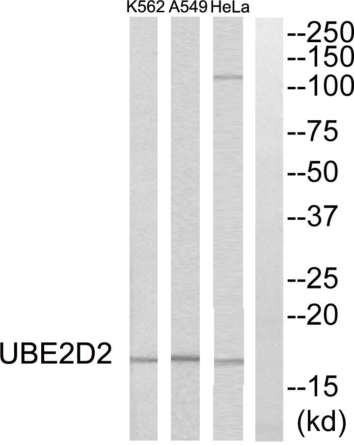 UBE2D2 Ab