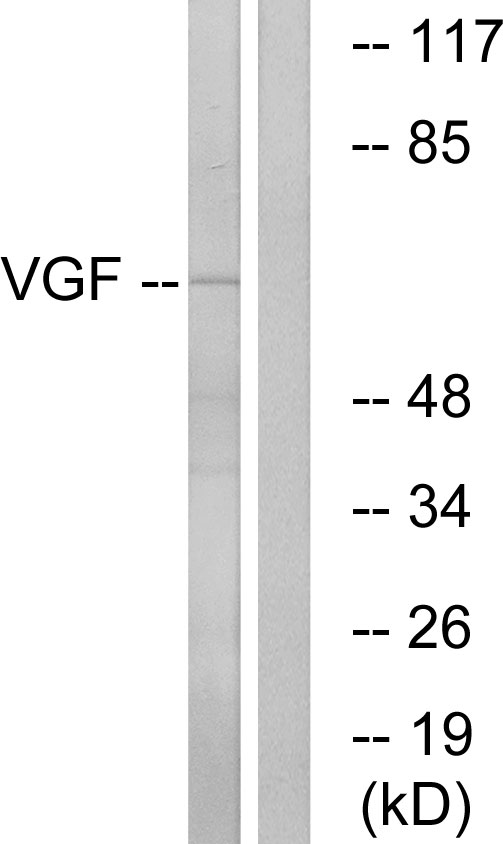 VGF Ab