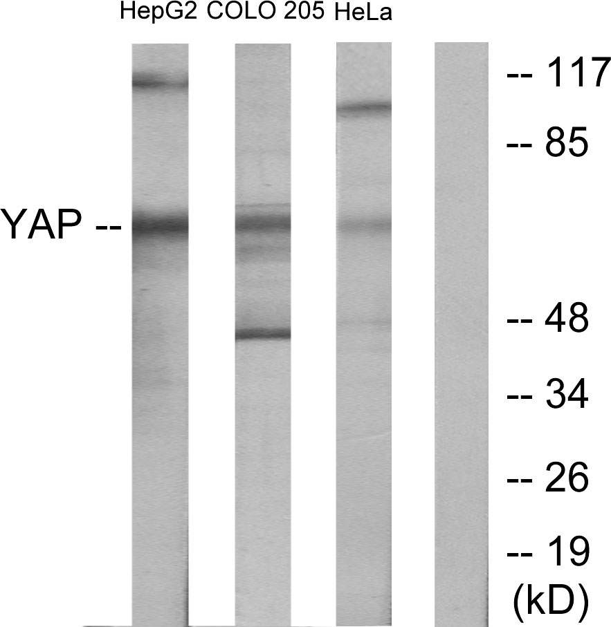 YAP1 Ab