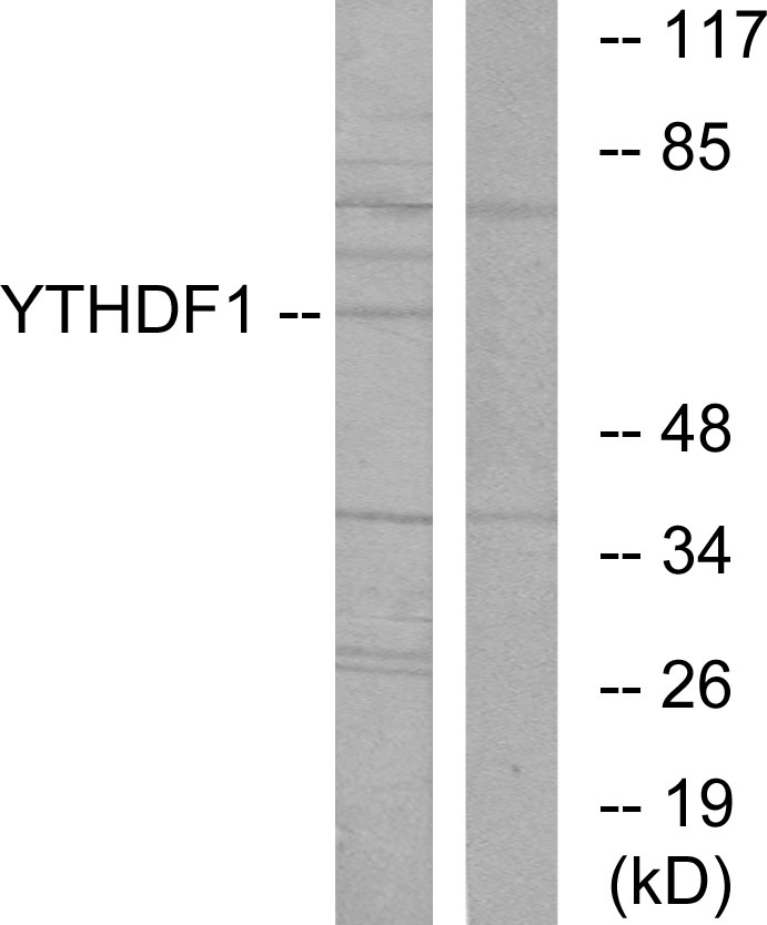 YTHDF1 Ab