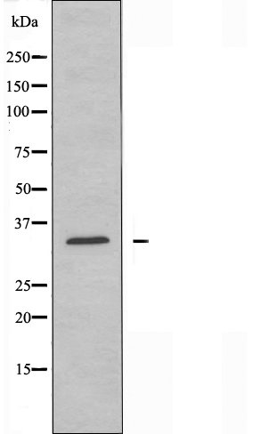 Prostaglandin reductase 2 Ab