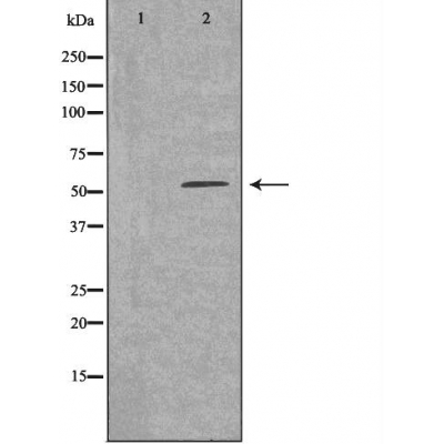 ZNF498 Ab