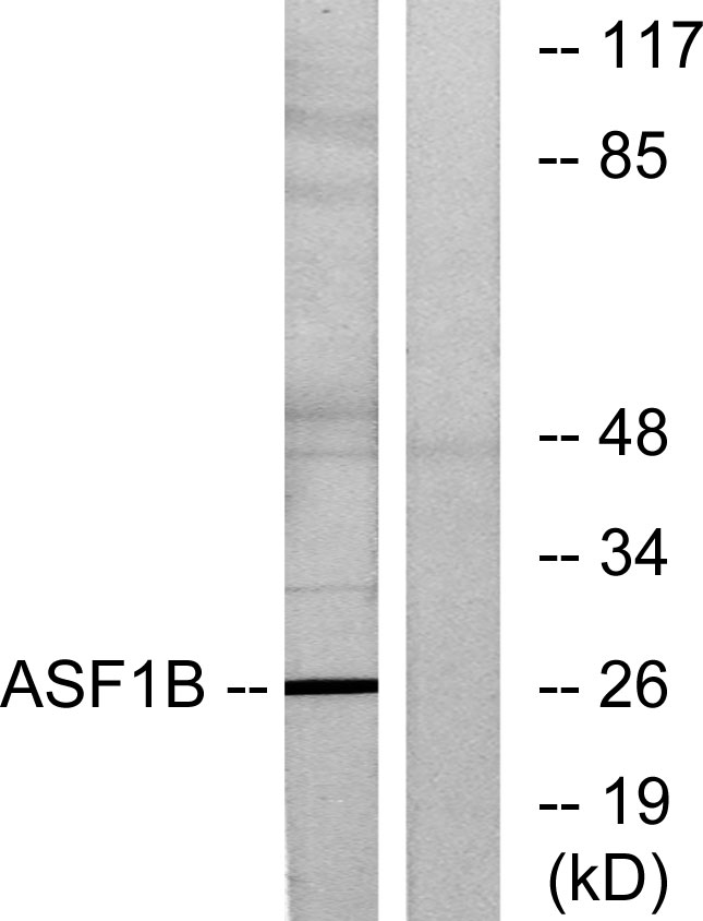 ASF1B Ab