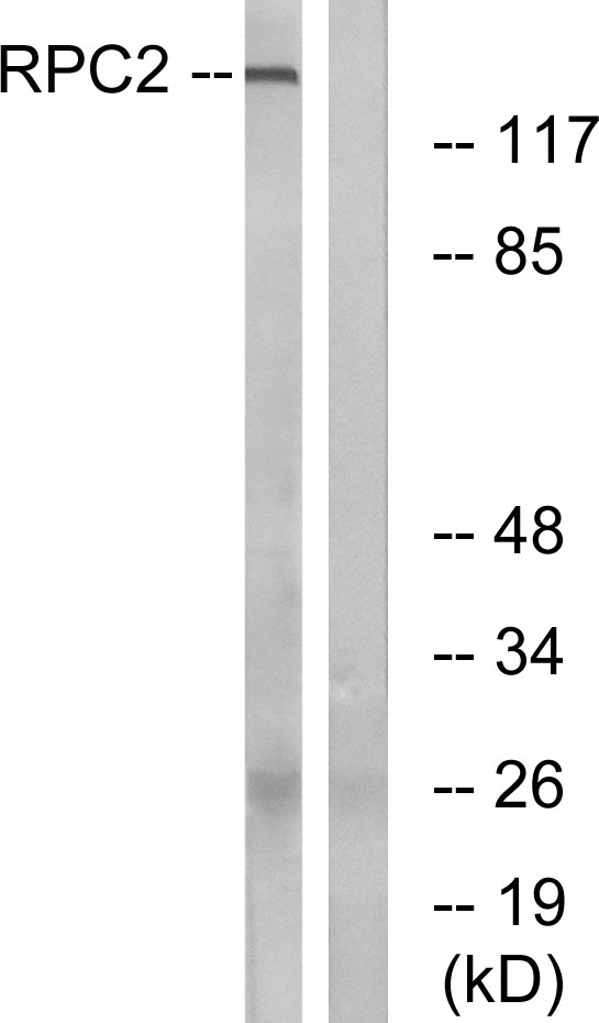 RPC2 Ab