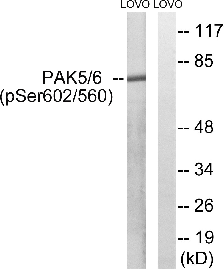 p-PAK5/6 (S602/S560) Ab