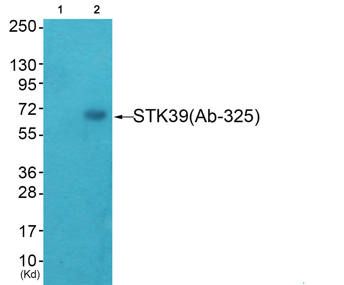 STK39 Ab