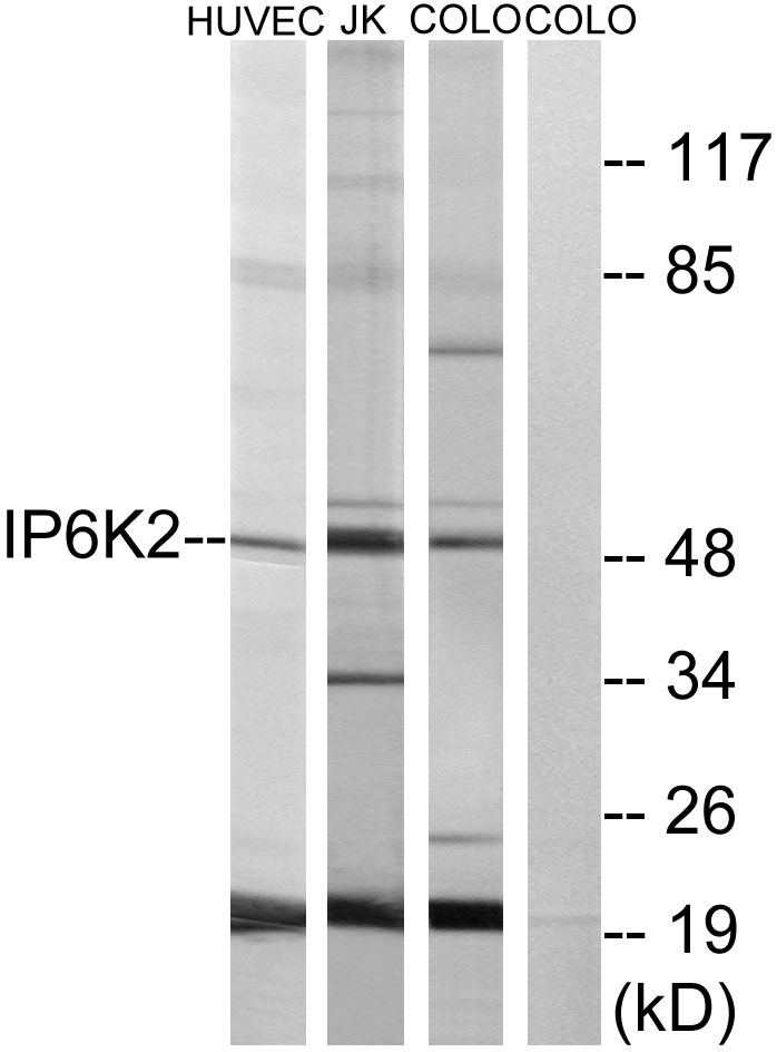 InsP6 kinase 2 Ab