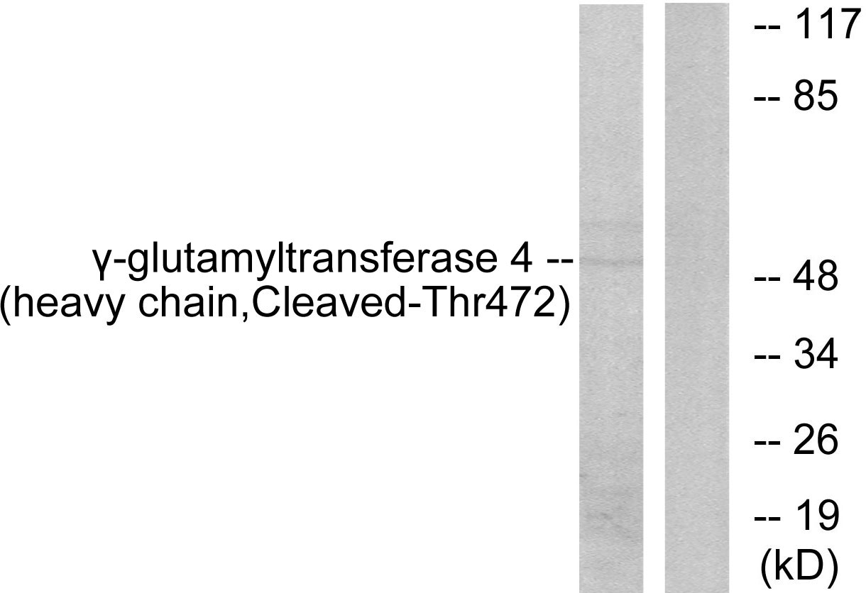 Glutathione hydrolase 7 heavy chain Ab