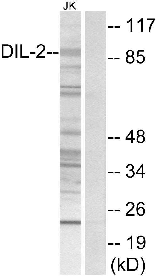 TPX2 Ab