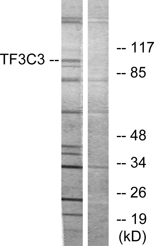 GTF3C3 Ab