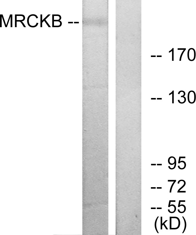 MRCK beta Ab