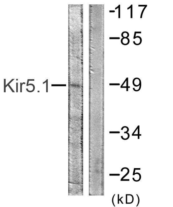 KCNJ16 Ab