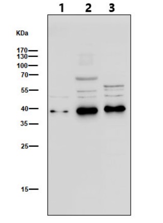 Collagen II alpha 1 Ab