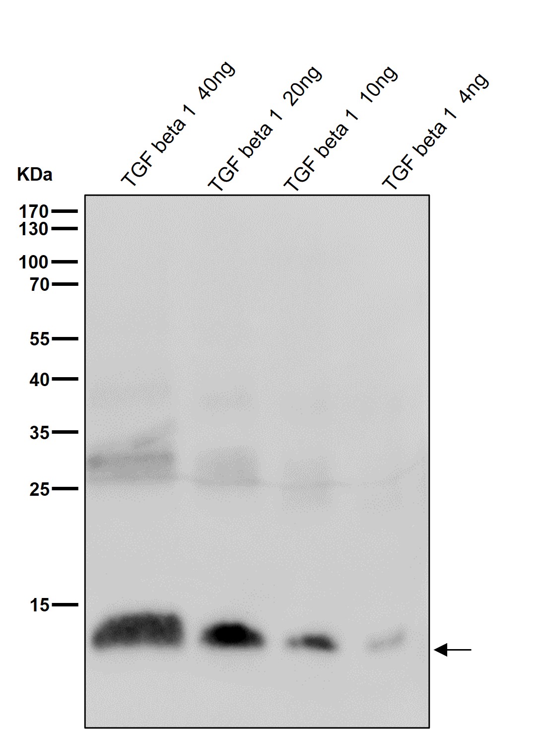 TGF beta 1 Ab