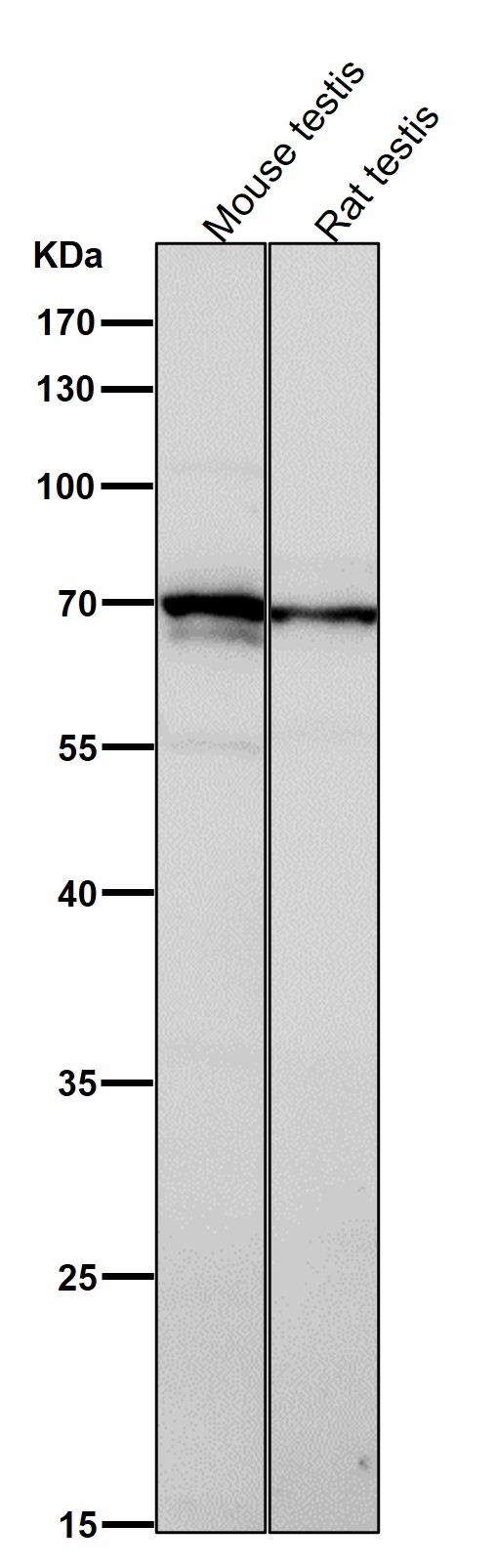 TXNRD3 Ab