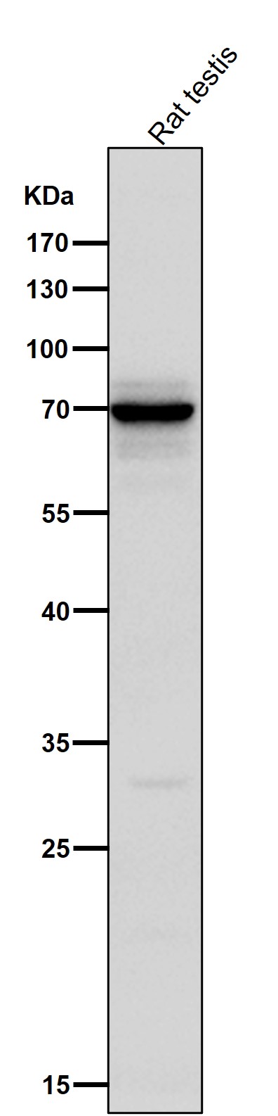 TXNRD3 Ab