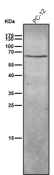 p-NF-kB p65 (S536) Ab