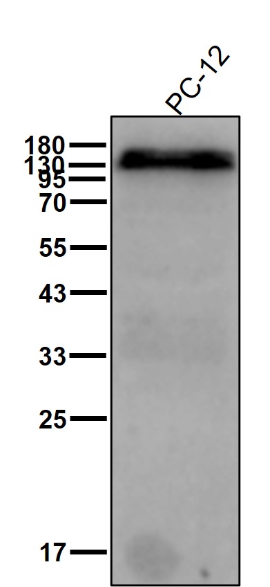 Nicastrin Ab