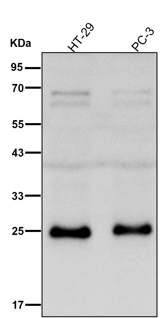 Thymidine kinase Ab