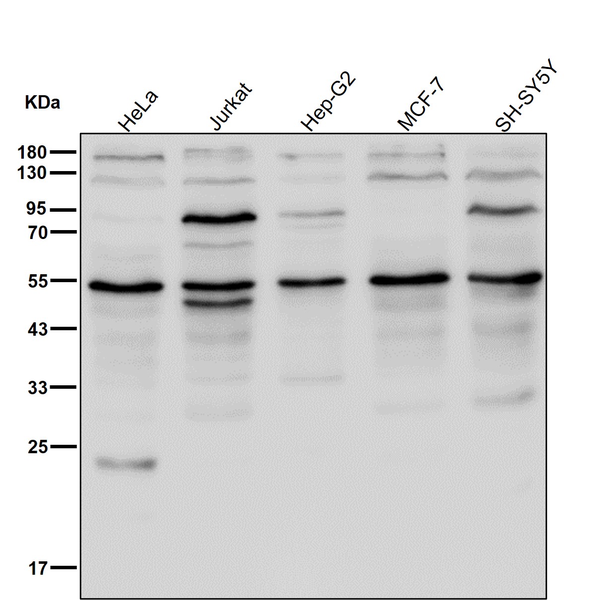 DAP kinase 3 Ab