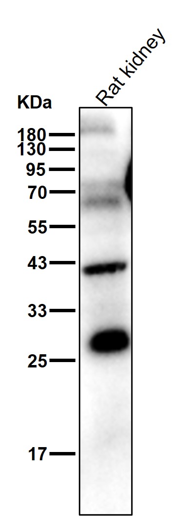 Complement C1q C Ab