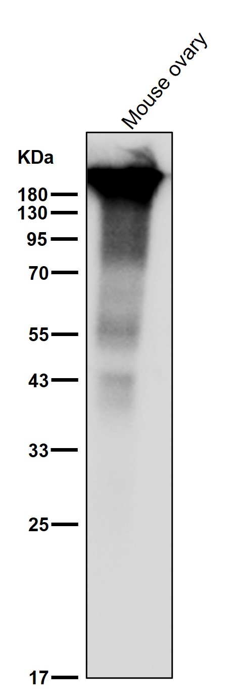 p-Acetyl CoA carboxylase (S221) Ab