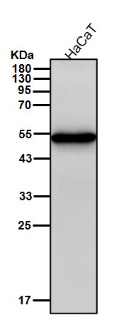 Cytokeratin 13 Ab