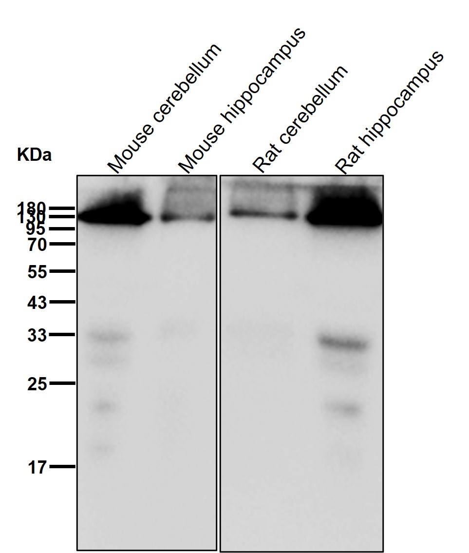 GluR1 Ab