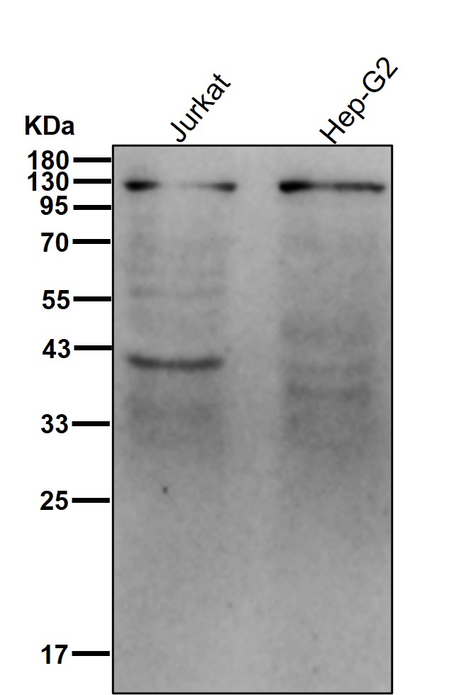 p-ATP citrate synthase (T447+S451) Ab