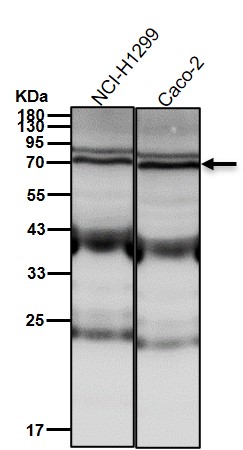 RPA p70 Ab