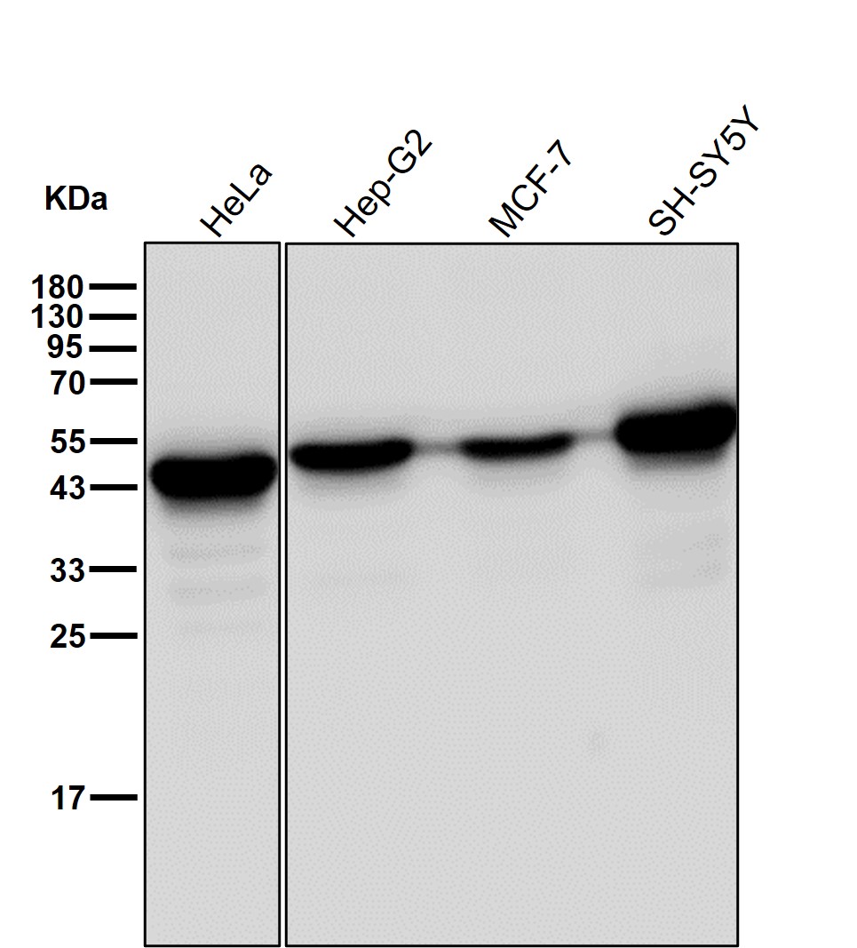 Creatine kinase B type Ab