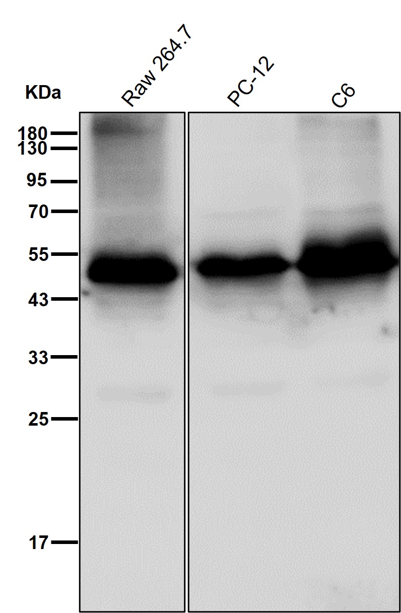 Creatine kinase B type Ab