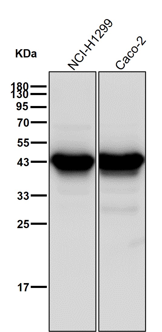 Creatine kinase B type Ab