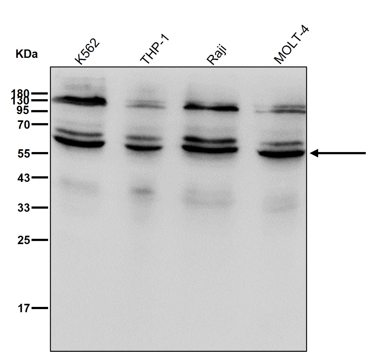 NTPDase 2 Ab