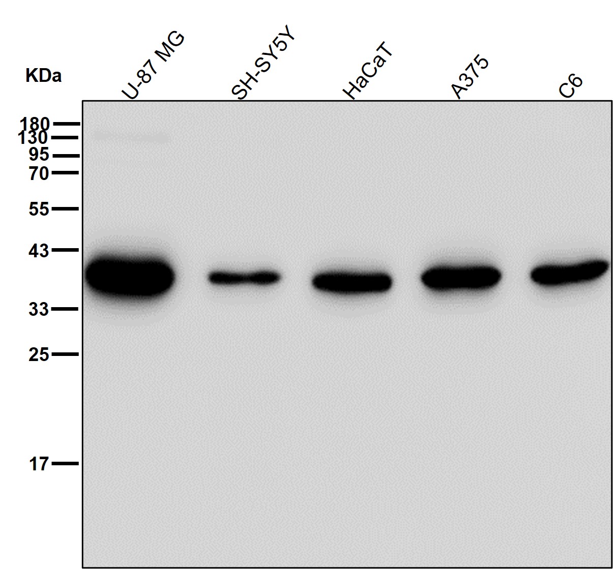 Hepatic leukemia factor Ab 