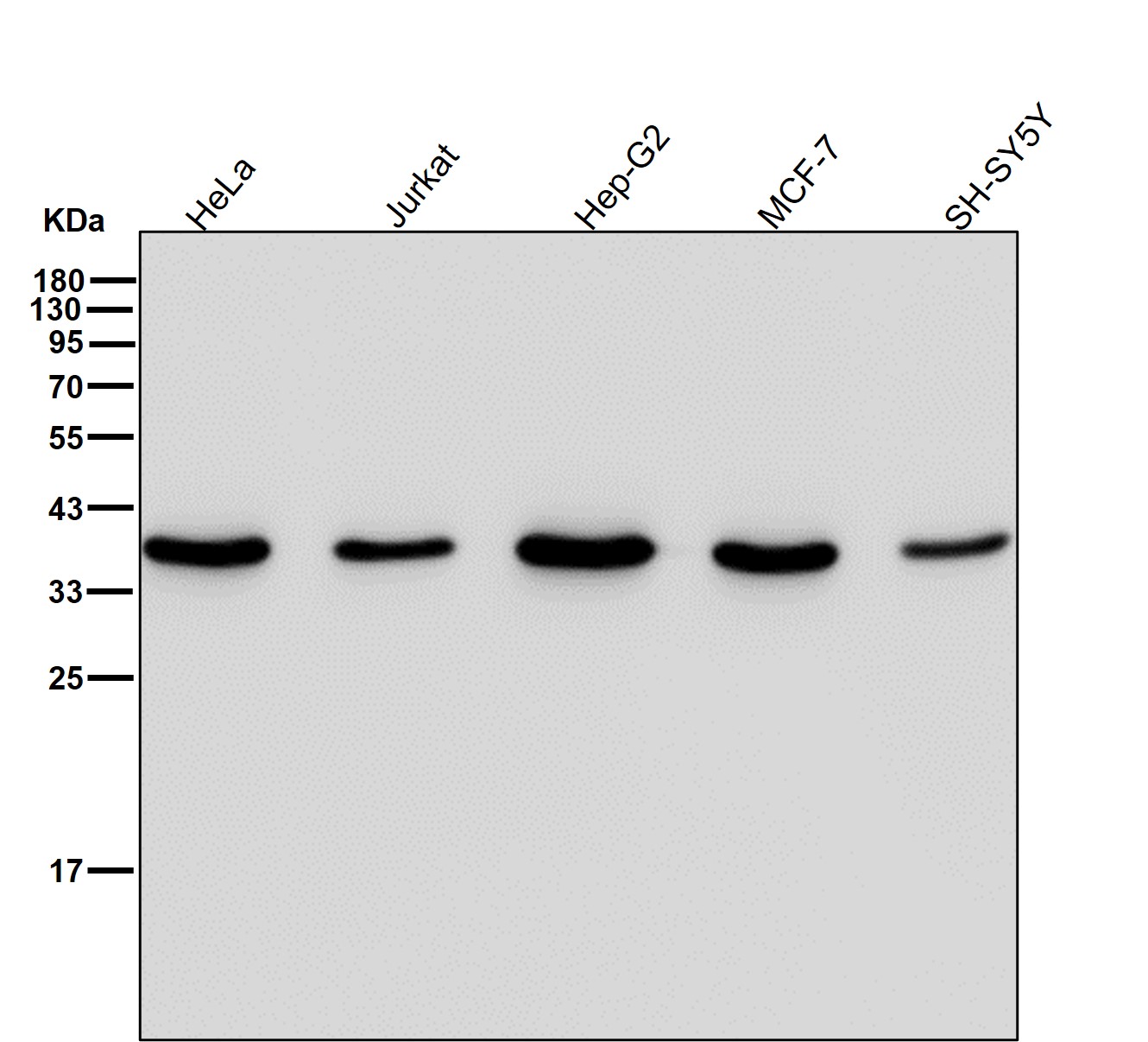 Hepatic leukemia factor Ab 