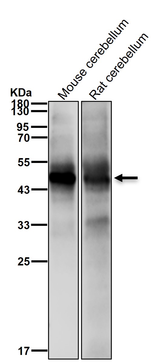 NeuroD Ab