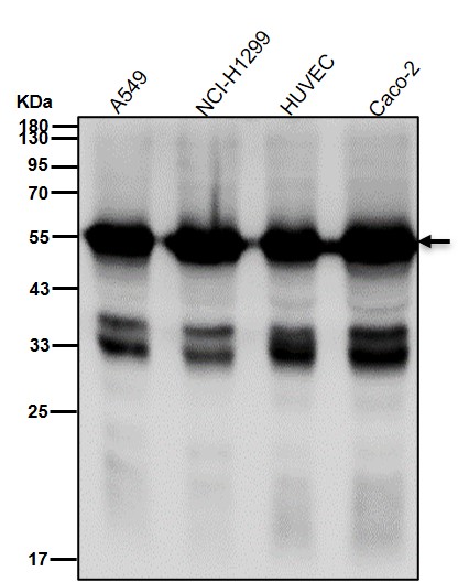 alpha 1B Tubulin Ab