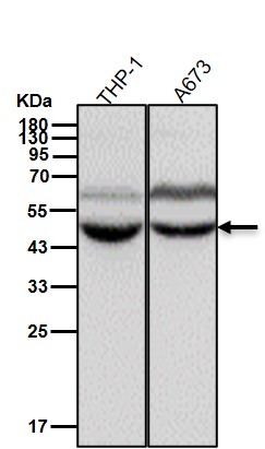 Squalene synthase Ab