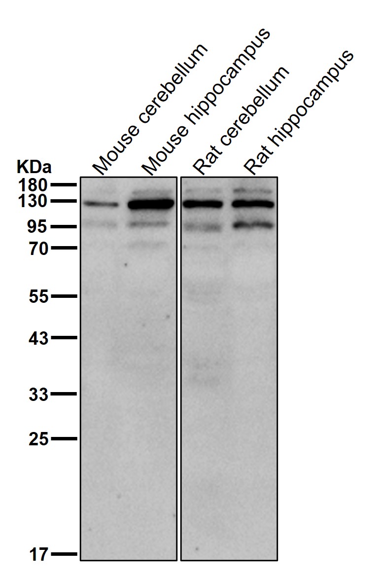 Focal adhesion kinase 1 Ab