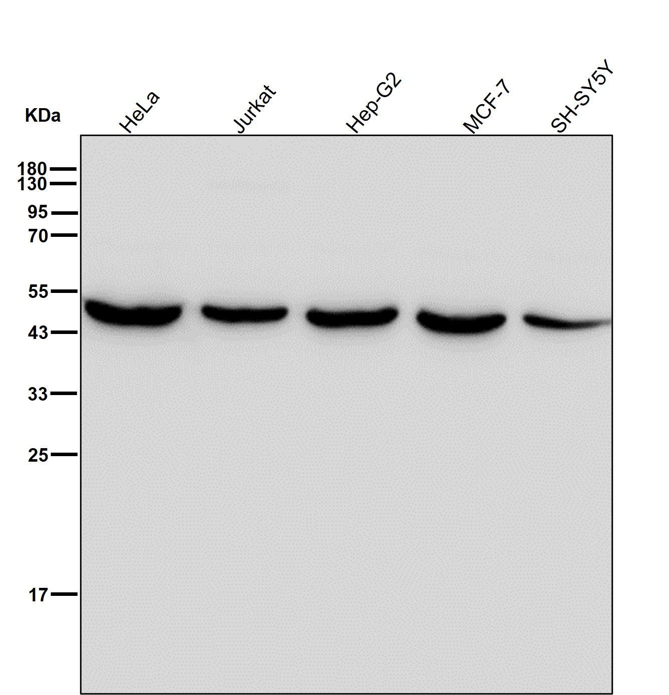 gamma Enolase Ab