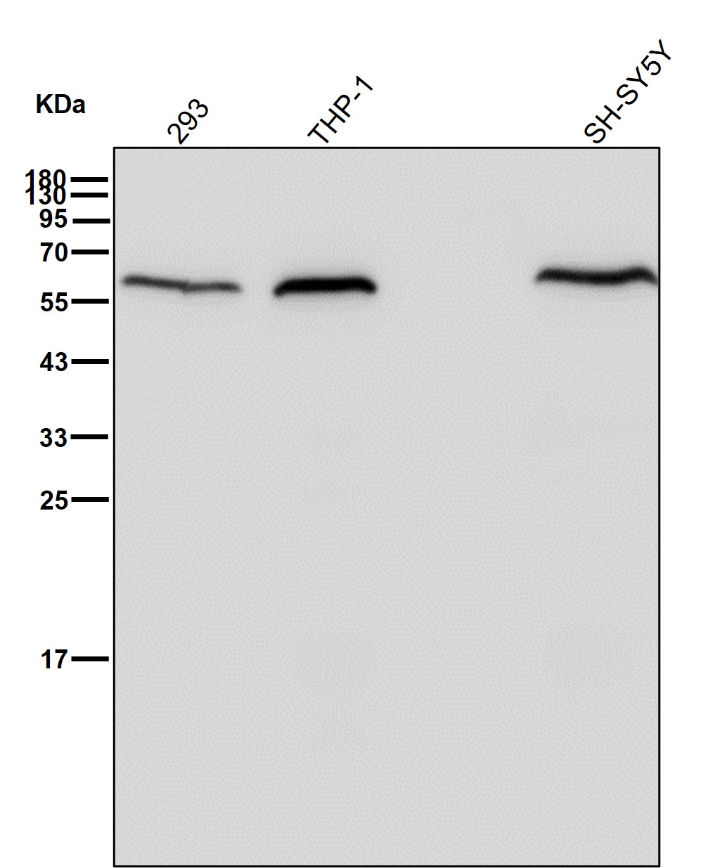 Calreticulin Ab