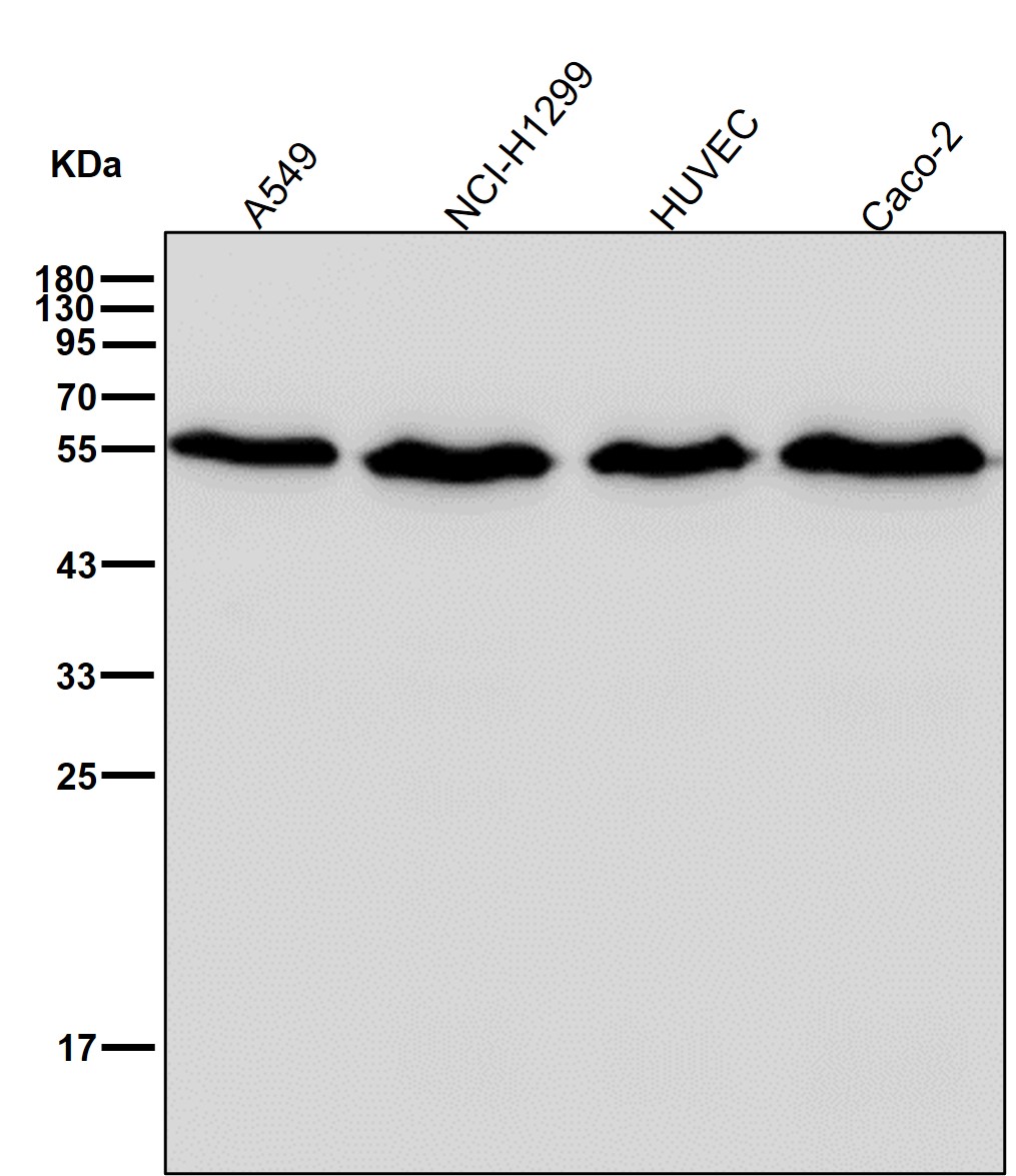 Calreticulin Ab