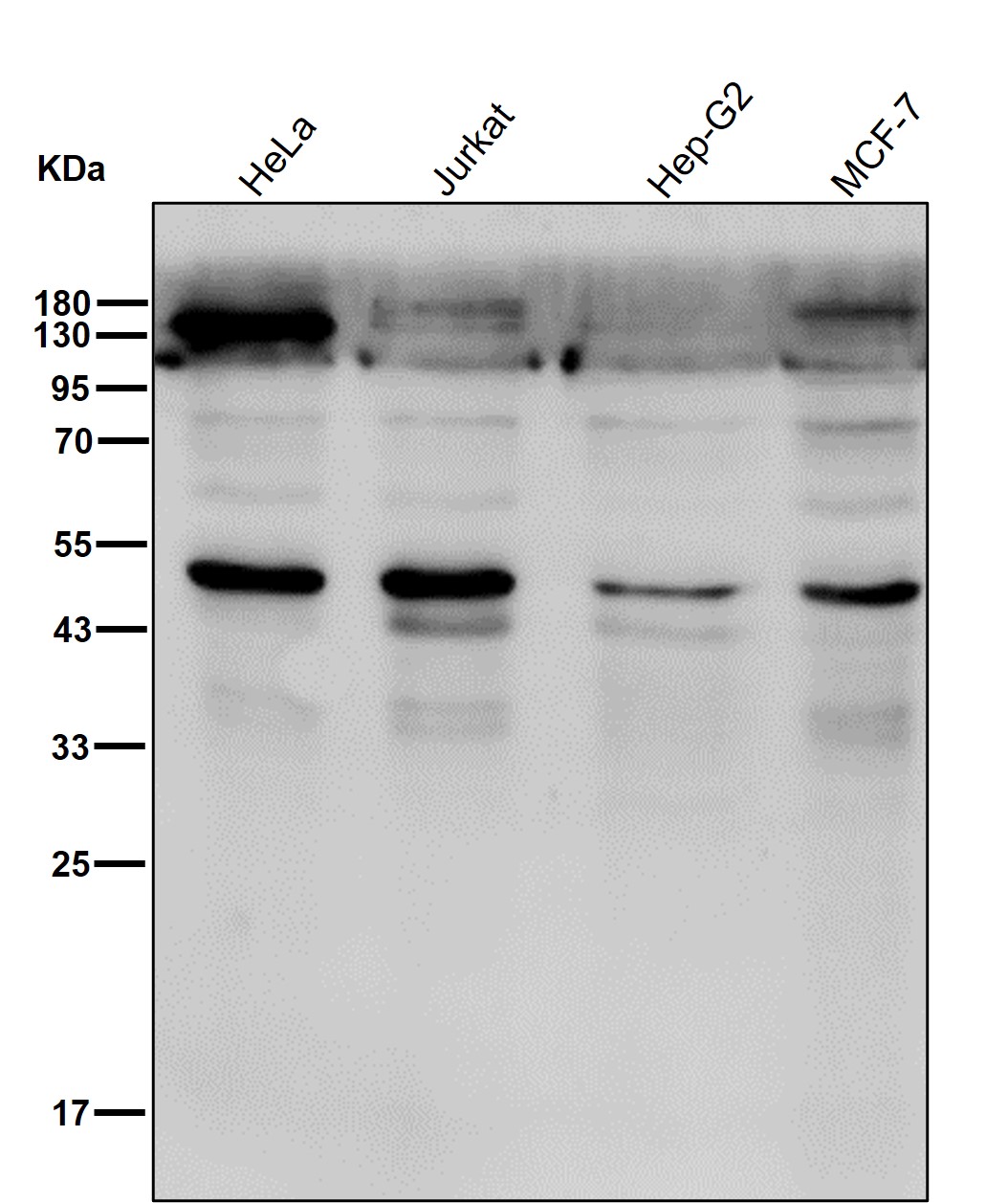 Phosphatase 1A Ab