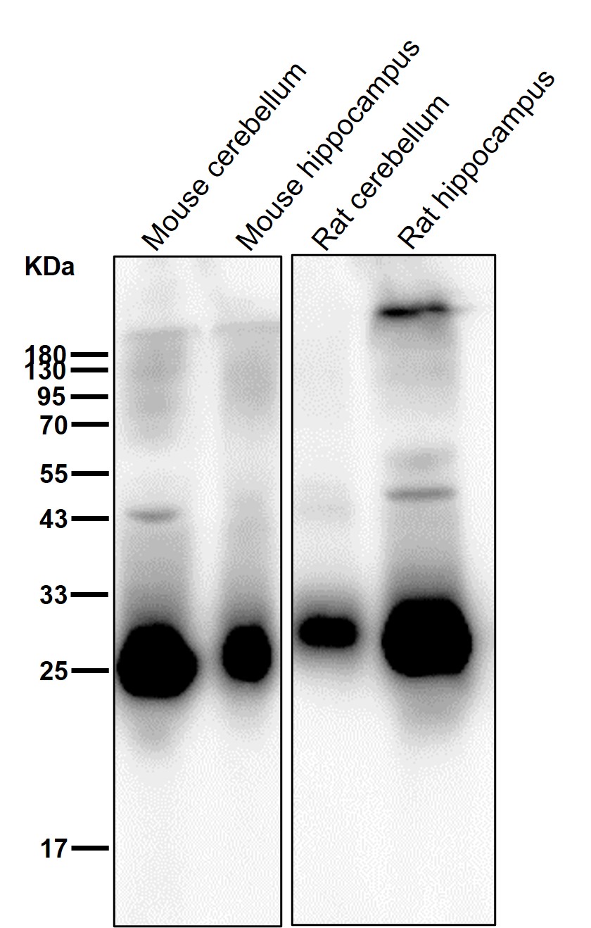 Myelin oligodendrocyte glycoprotein Ab