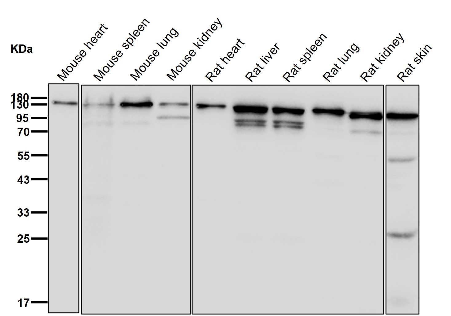 Xanthine oxidase Ab