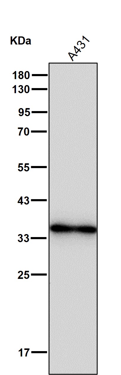 Cytochrome b5 reductase Ab